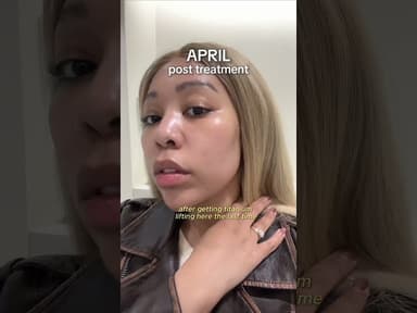 Erase Your Double Chin at Doctor Petit