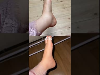 Ultra-Gentle Lymph Care Explained ✨