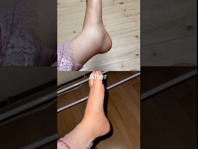 Ultra-Gentle Lymph Care Explained ✨