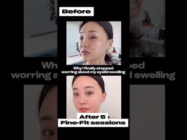 I Got This Lymph Care Right After Surgery 😳✨